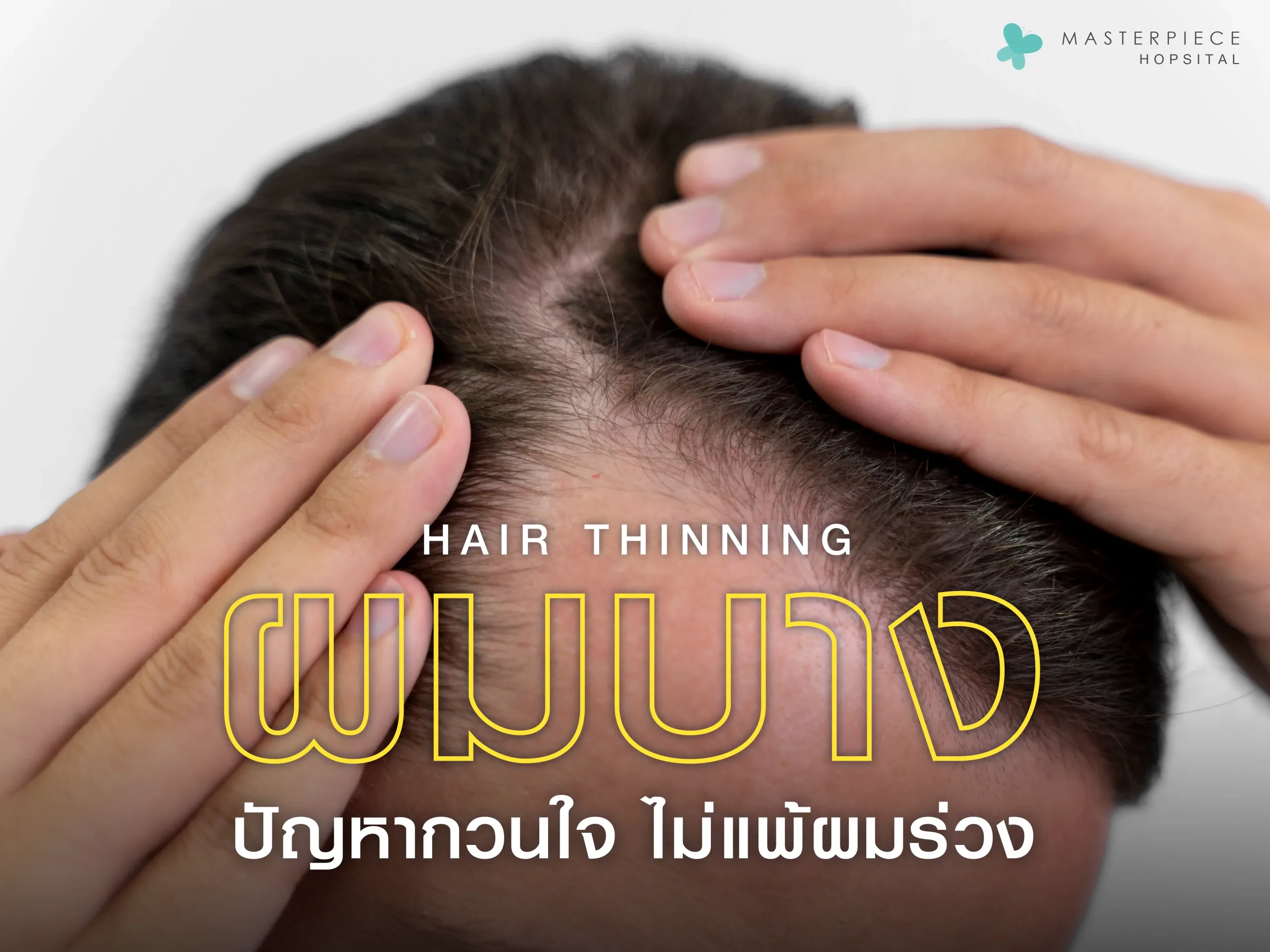 ผมบาง ปัญหาหวนใจ ไม่แพ้ผมร่วง