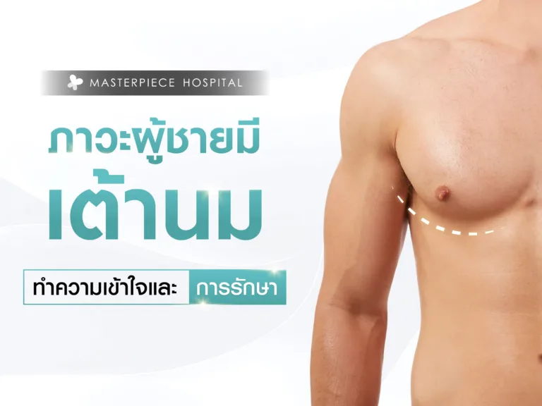 ทำไมผู้ชายถึงมีเต้านม? ทำความเข้าใจภาวะเต้านมโตและการรักษาด้วยการดูดไขมัน