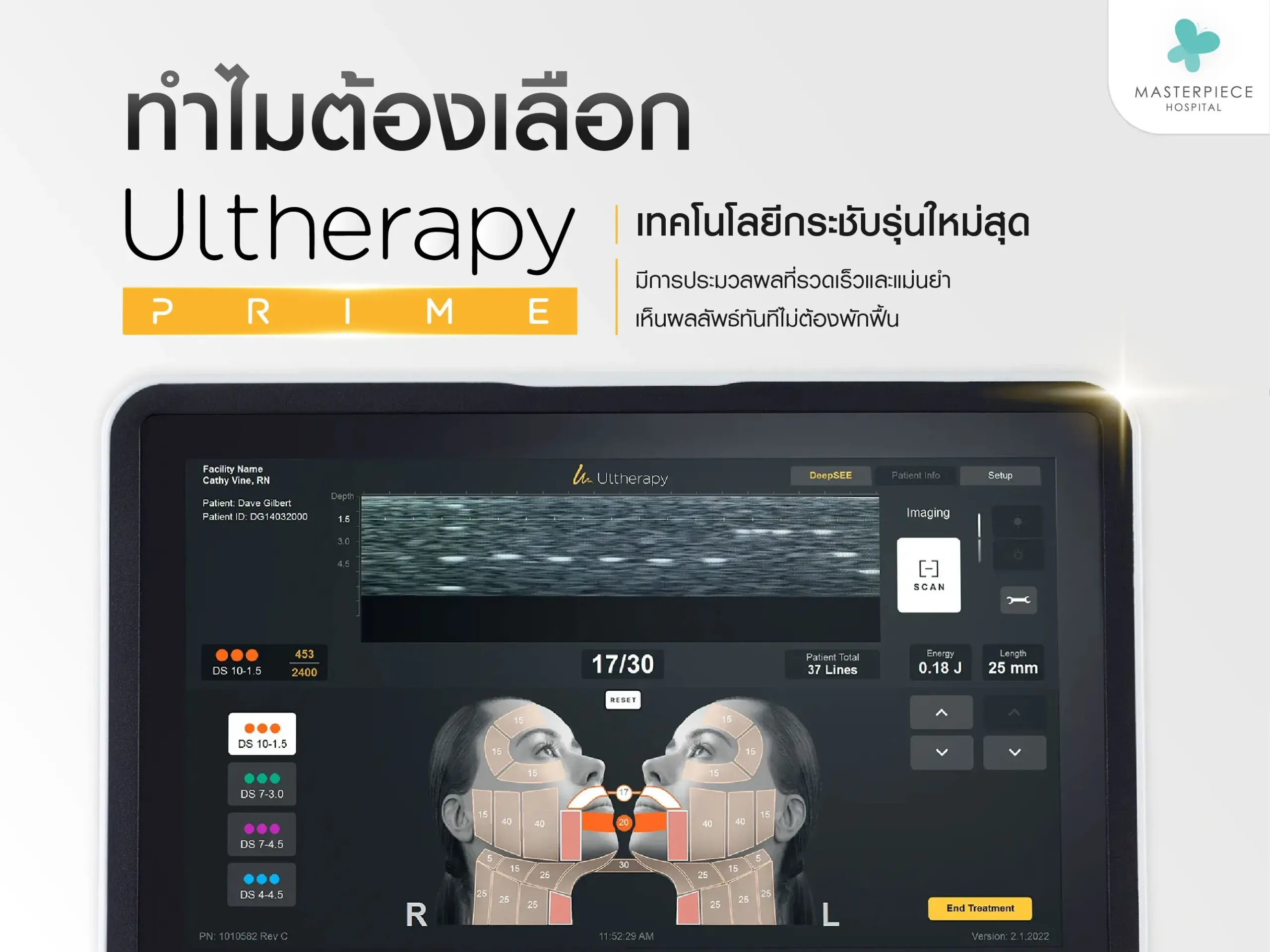 เหตุผลทำไมต้องเลือก Ultherapy prime