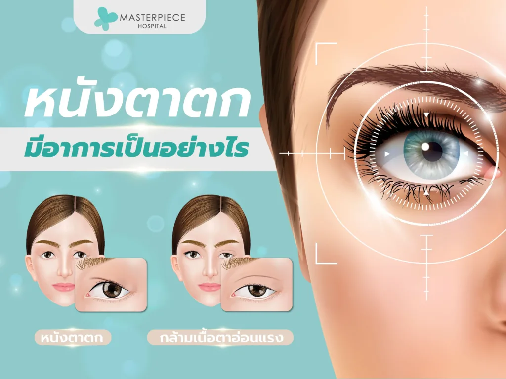 หนังตาตก
