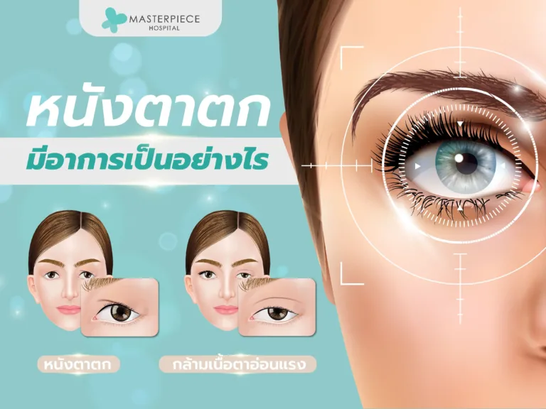 หนังตาตก
