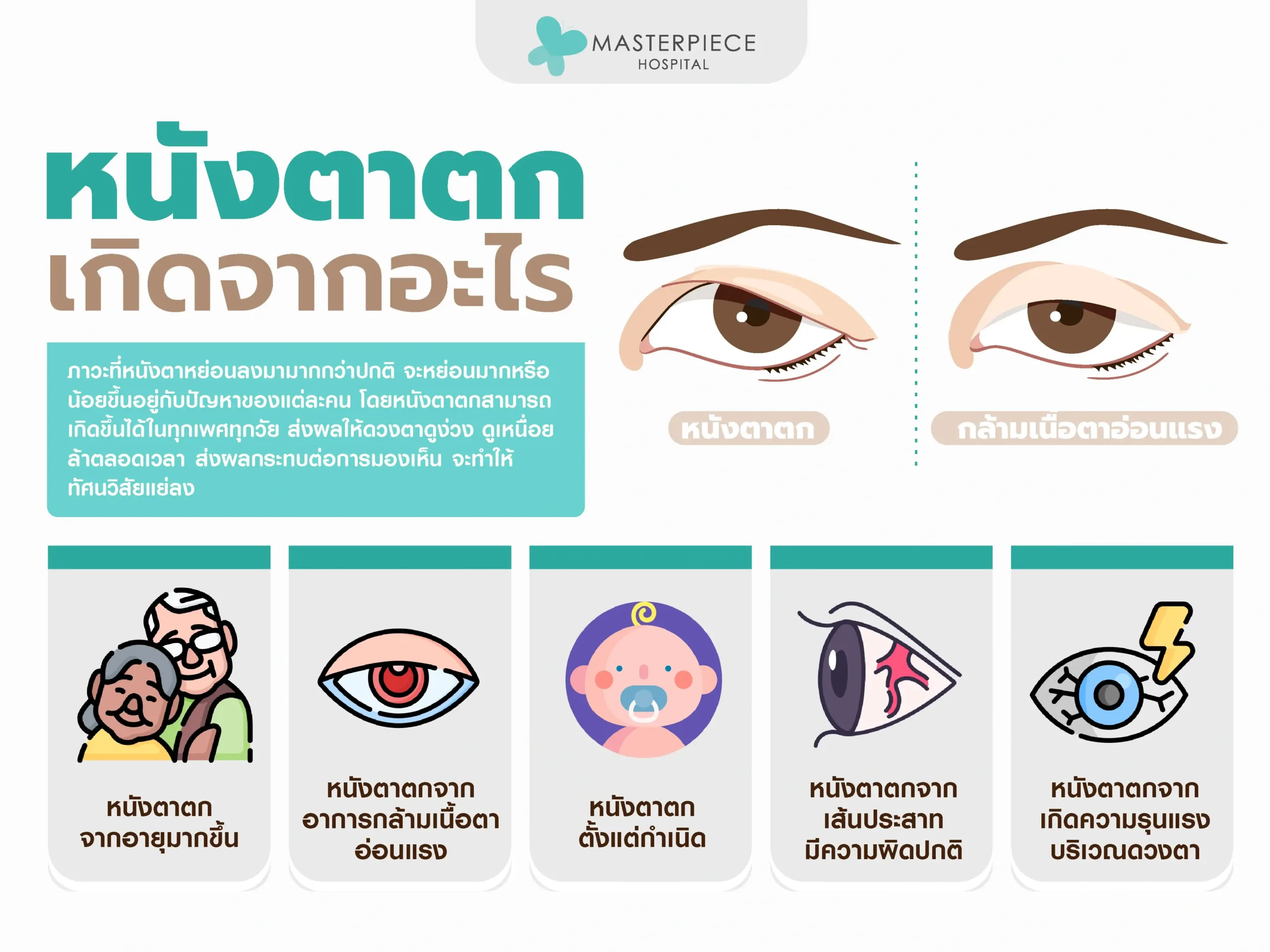 หนังตาตกเกิดจากอะไร