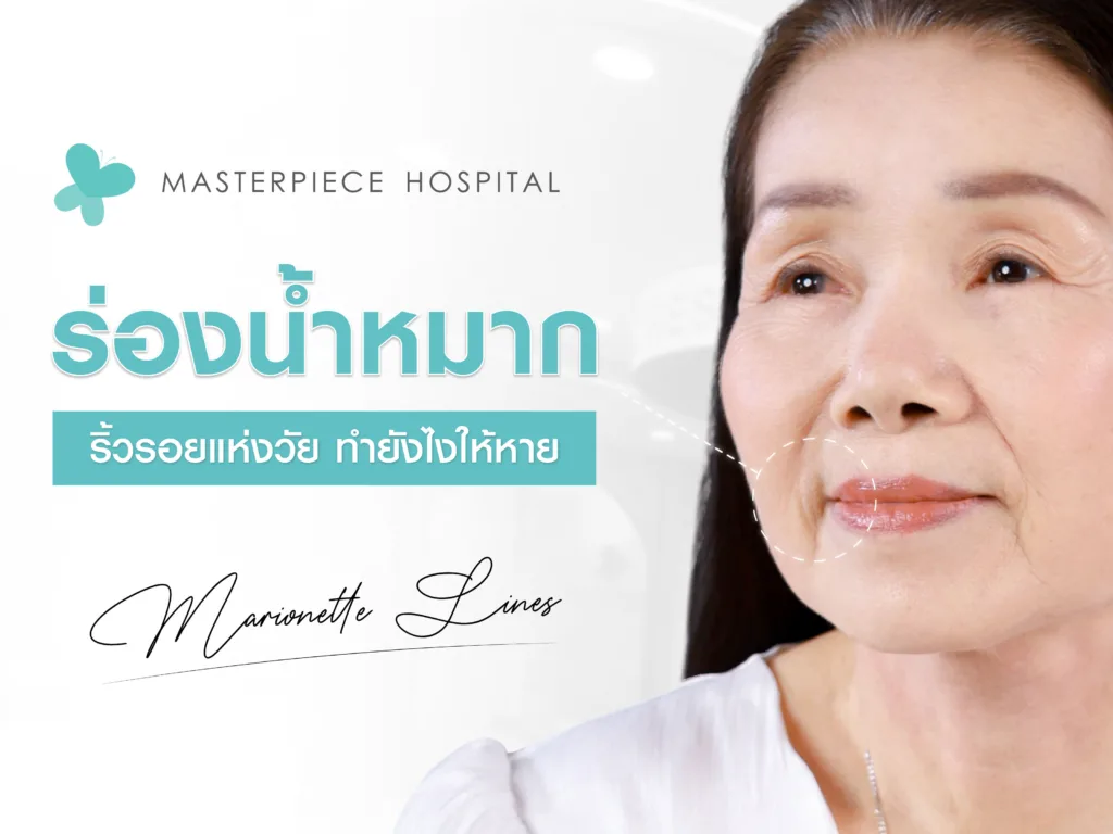 ร่องน้ำหมาก ริ้วรอยแห่งวัย