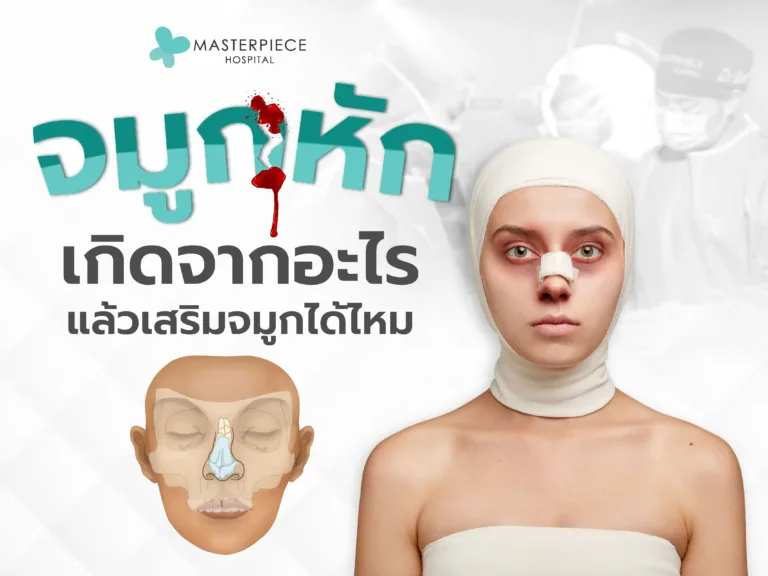 จมูกหักเกิดจากอะไร ทำอย่างไรดี แล้วเสริมจมูกได้ไหม