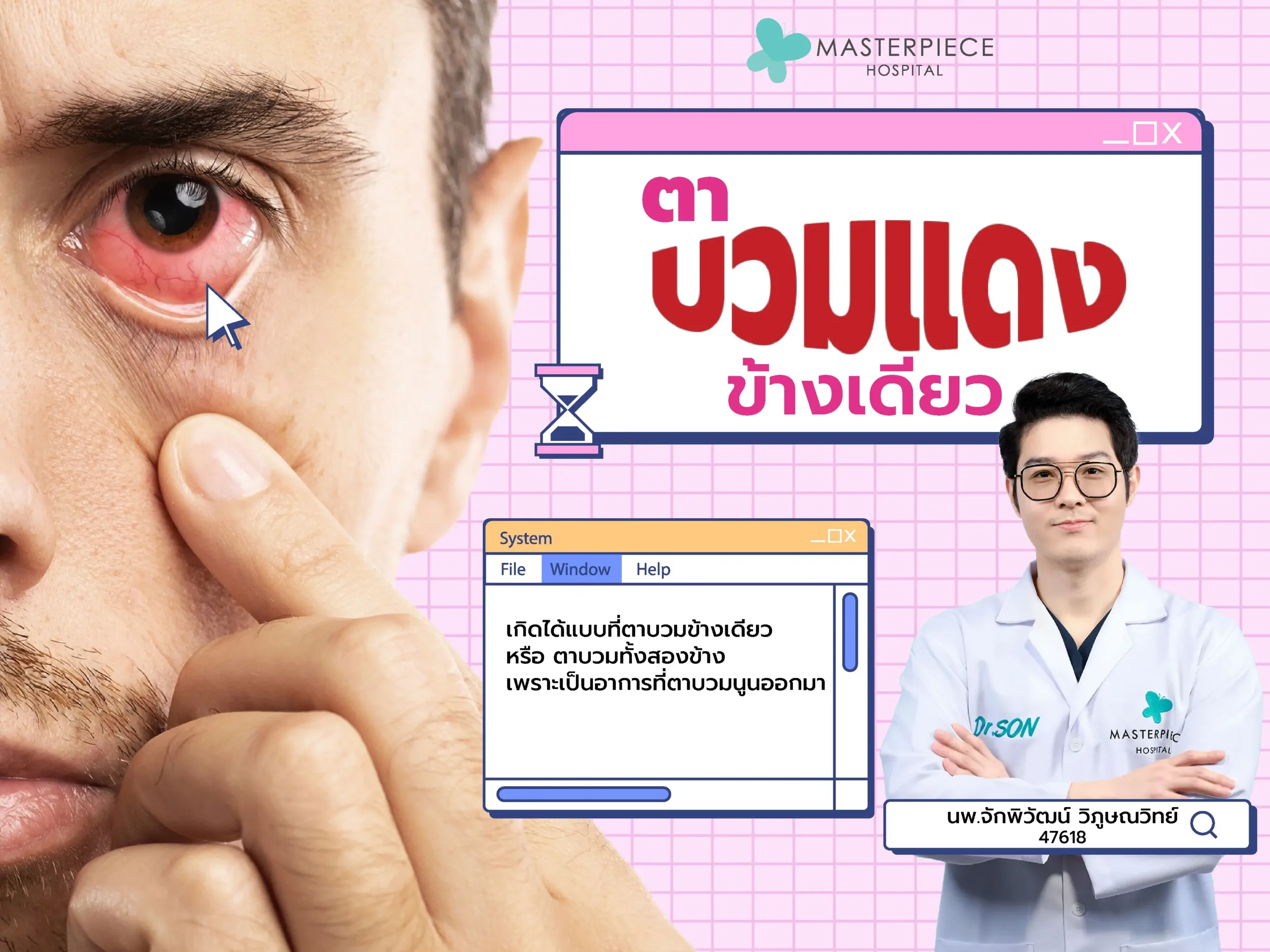 ตาบวมข้างเดียวเกิดจากอะไร