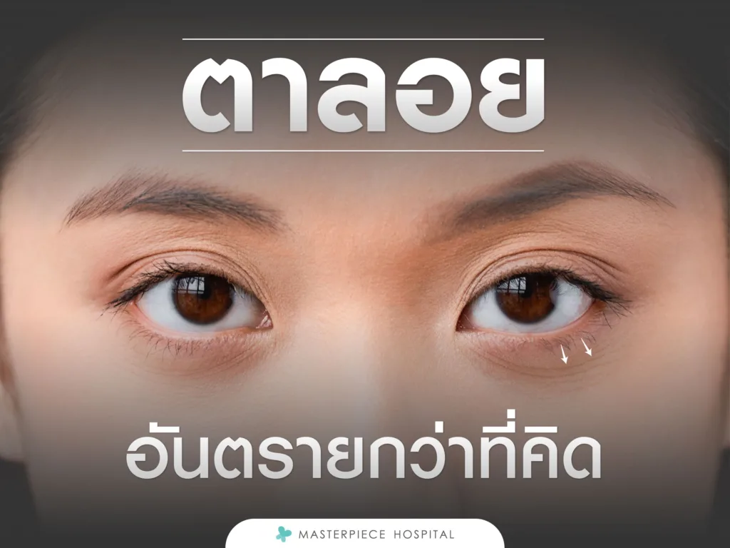 ตาลอย