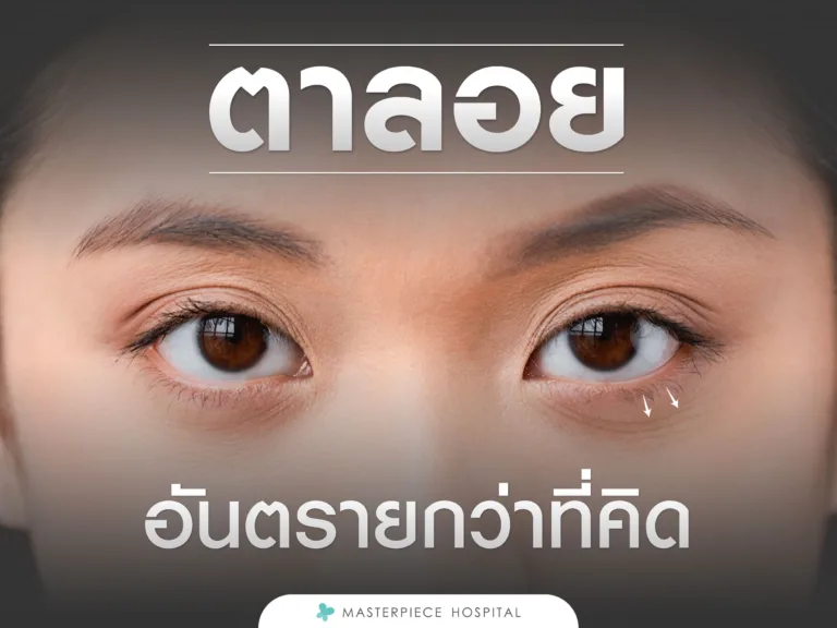 ตาลอย
