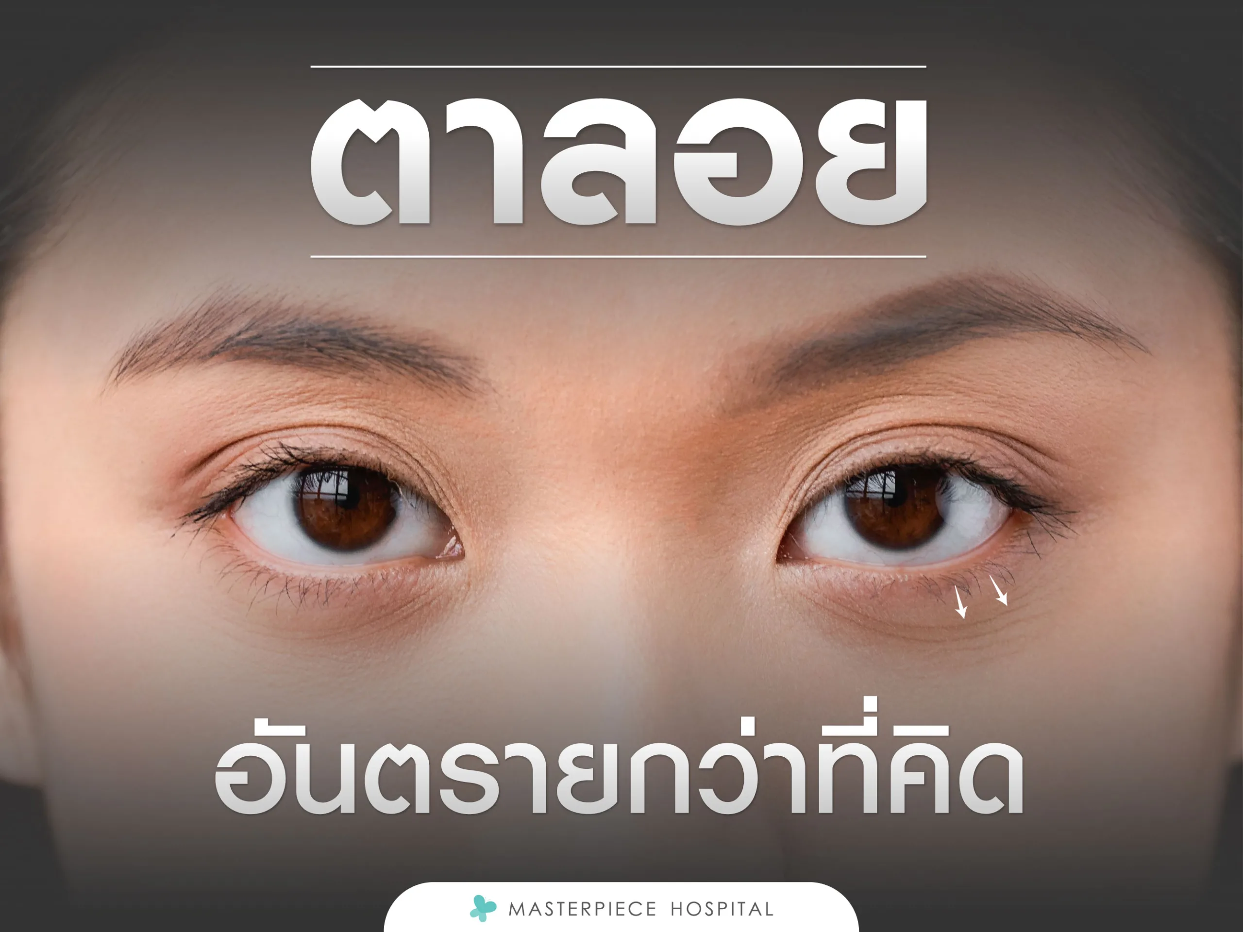 ตาลอย