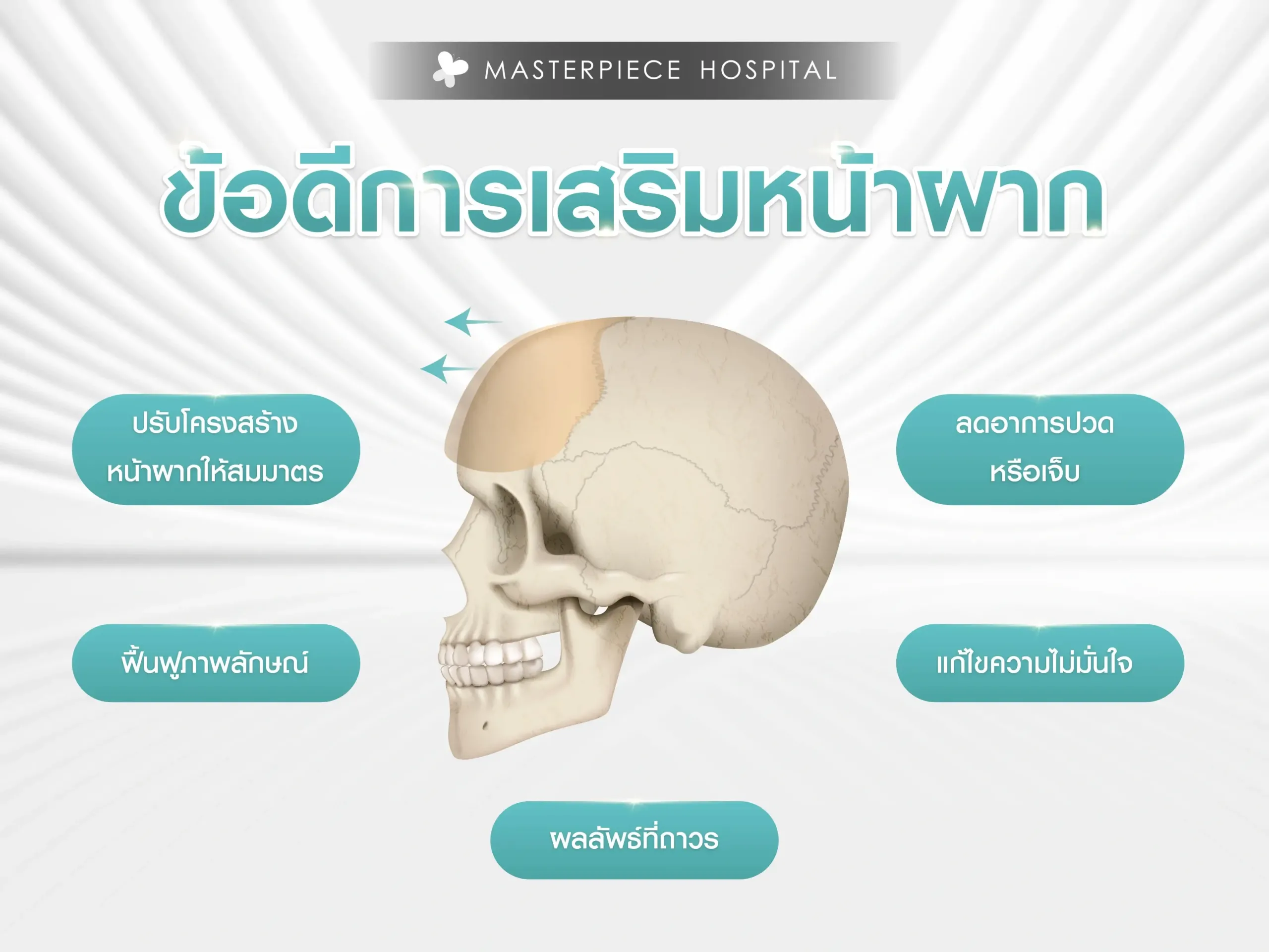 ข้อดีของการเสริมหน้าผากเพื่อแก้ไขกระดูกหน้าผากผิดรูป