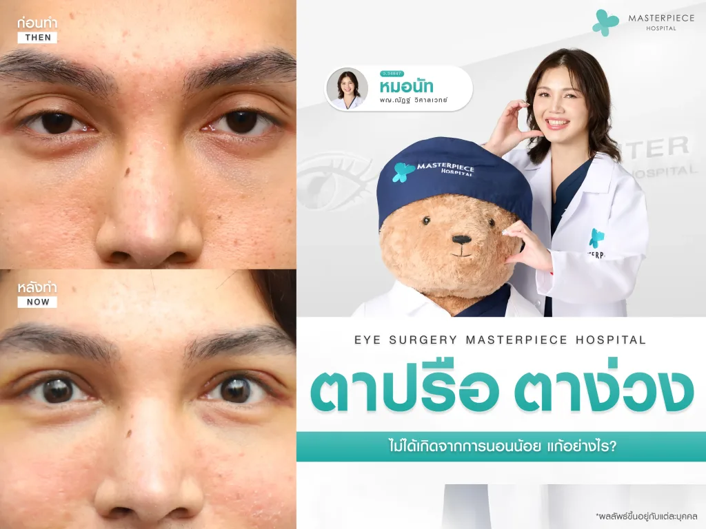 ตาปรือตาง่วง