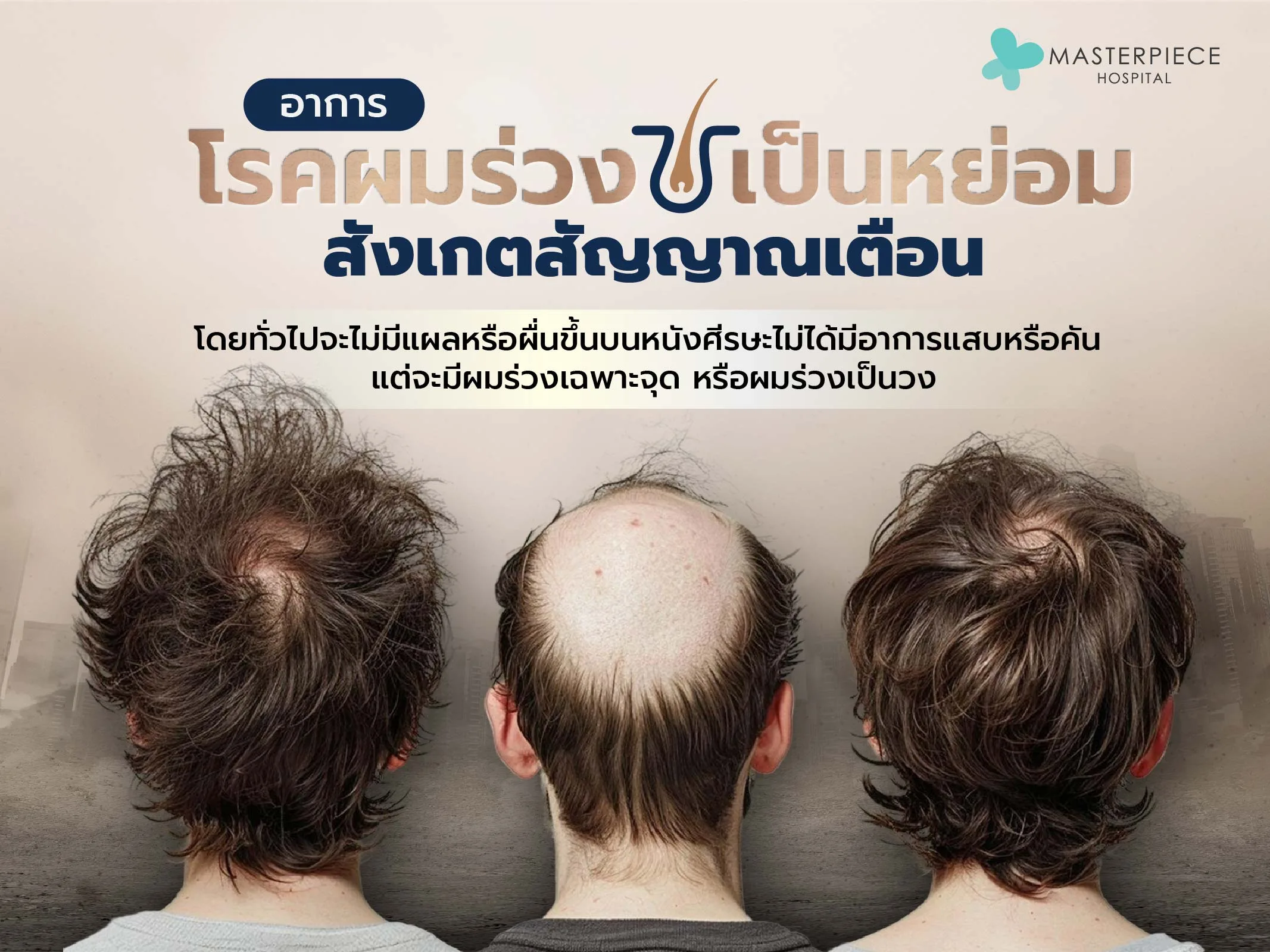 อาการของโรคผมร่วงเป็นหย่อม