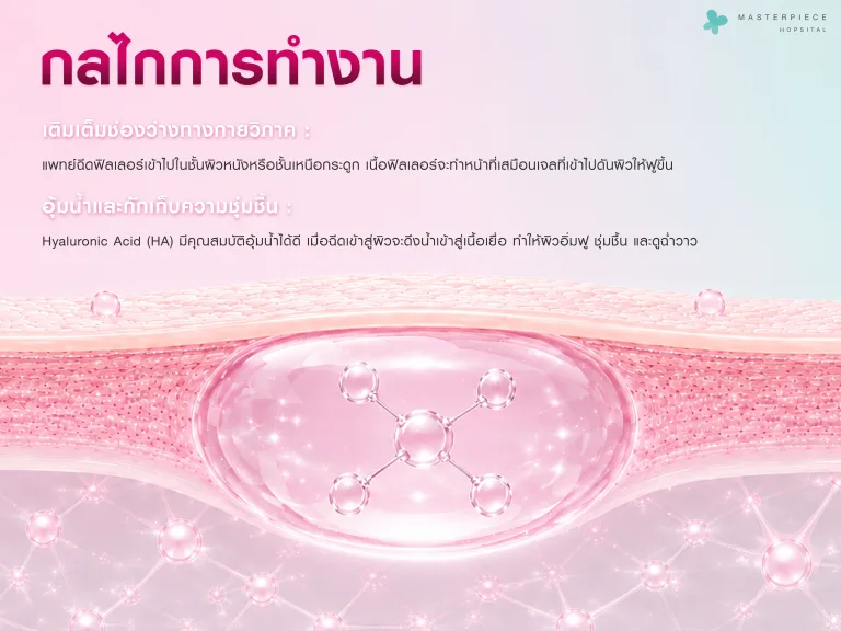 กลไกการทำงานของฟิลเลอร์