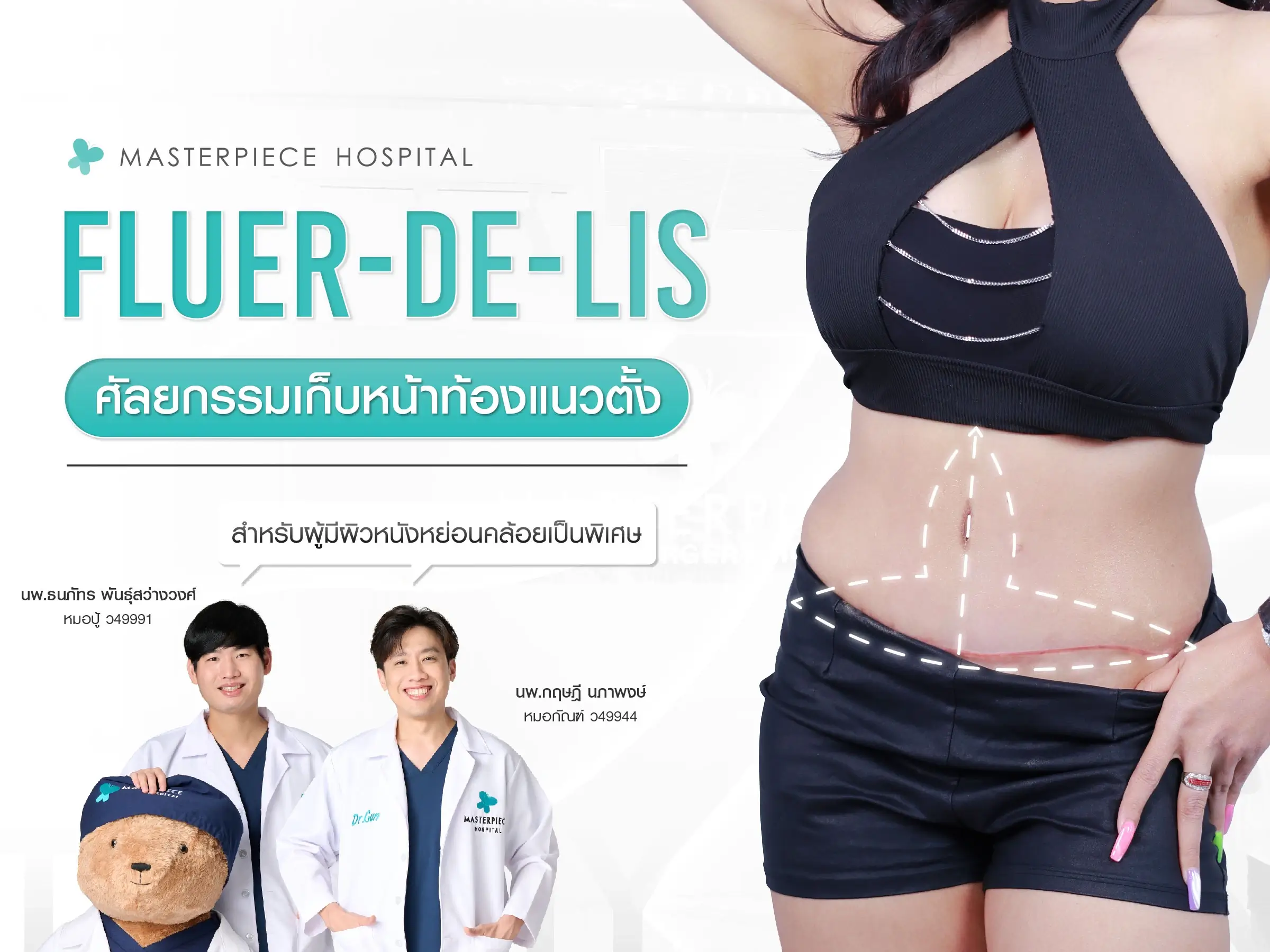 รู้จัก Fleur-de-lis Tummy Tuck ศัลยกรรมเก็บหน้าท้องแนวตั้ง สำหรับผู้มีผิวหนังหย่อนคล้อยมากเป็นพิเศษ