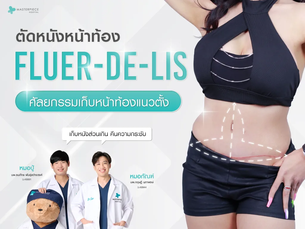ตัดหนังหน้าท้อง Fleur-de-lis (Tummy Tuck) เก็บหนังส่วนเกิน คืนความกระชับ