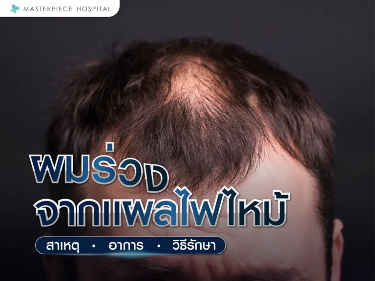 ผมร่วงจากแผลไฟไหม้ สาเหตุ อาการ และวิธีรักษา