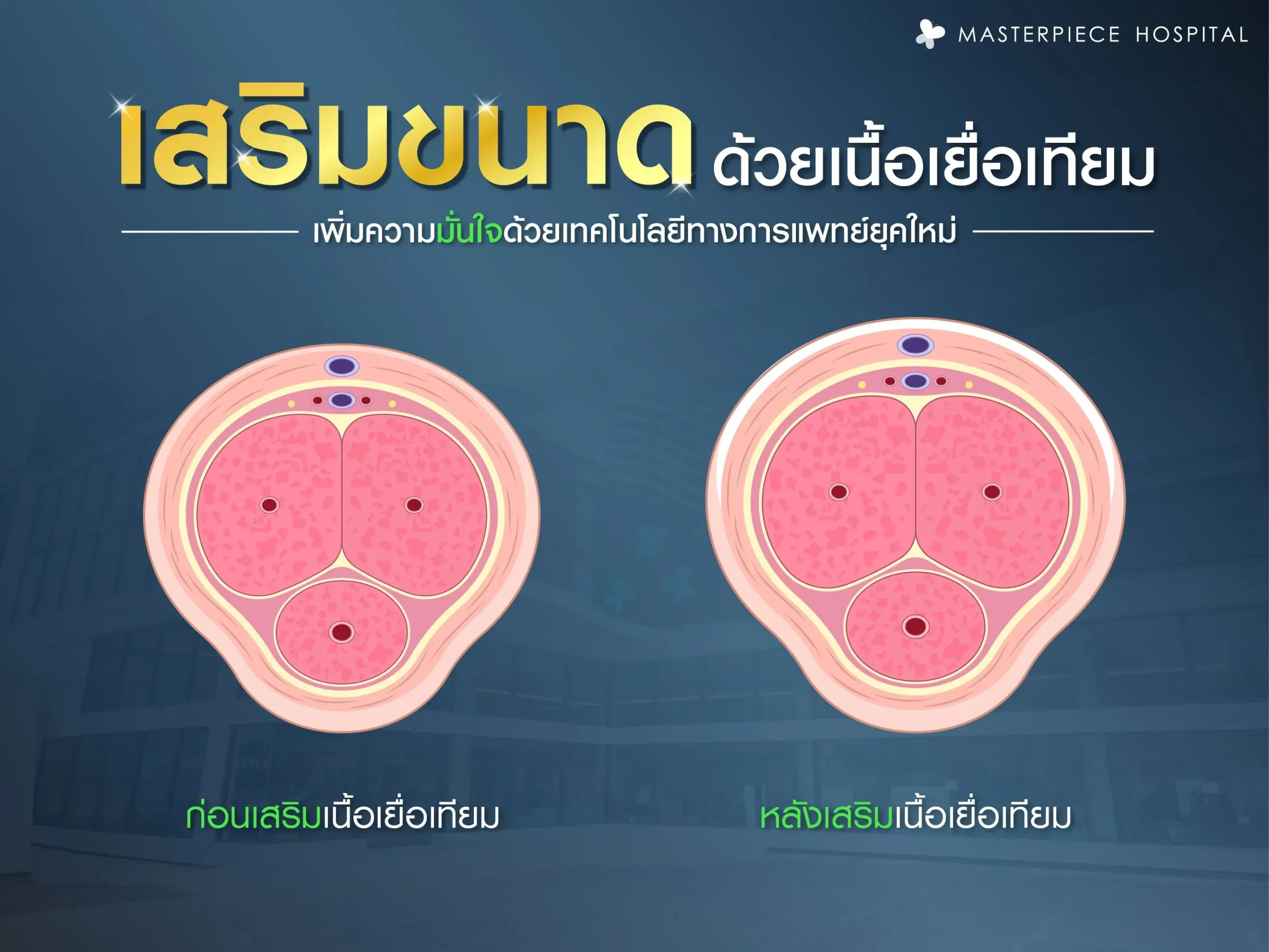 เสริมขนาดด้วยเนื้อเยื่อเทียม เพิ่มความมั่นใจด้วยเทคโนโลยีทางการแพทย์ยุคใหม่