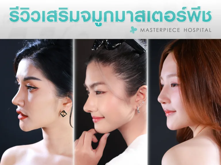 รวมรีวิวเสริมจมูกผลงานของโรงพยาบาลมาสเตอร์พีช มีทรงไหนบ้าง แบบไหนบ้าง
