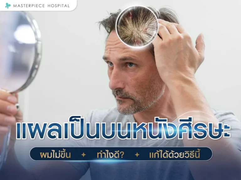 แผลเป็นบนหนังศีรษะ ผมไม่ขึ้น ทำไงดี แก้ได้ด้วยวิธีนี้