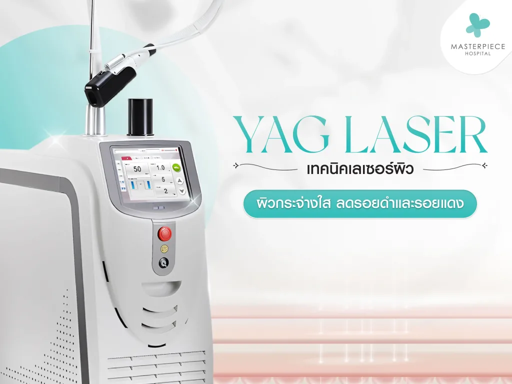 YAG Laser เทคนิคเลเซอร์เพื่อผิวกระจ่างใส ลดรอยดำและรอยแดงอย่างมีประสิทธิภาพ