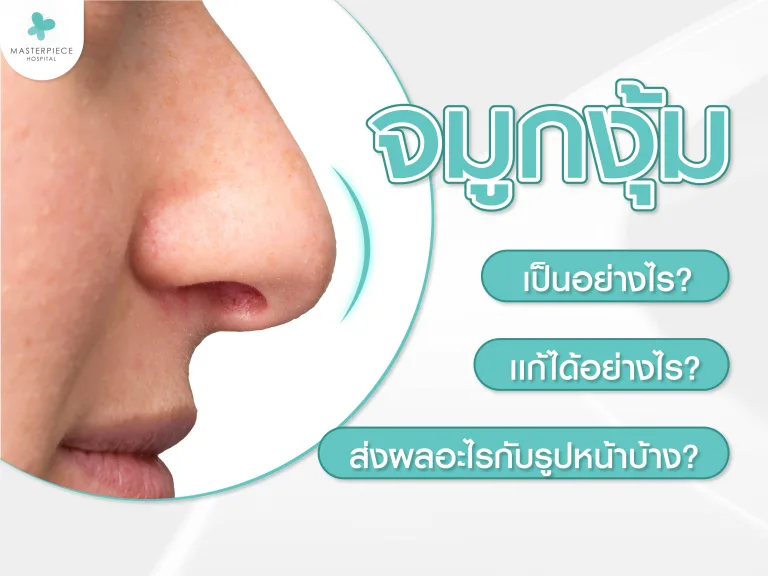 จมูกงุ้มเป็นอย่างไร ส่งผลอะไรกับรูปหน้าบ้าง และแก้ได้อย่างไร