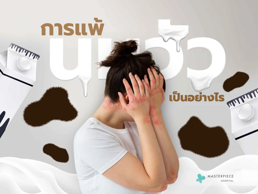 การแพ้นมวัวเป็นอย่างไร มีอาการแบบไหนบ้าง เกิดจากอะไร หายได้ไหม