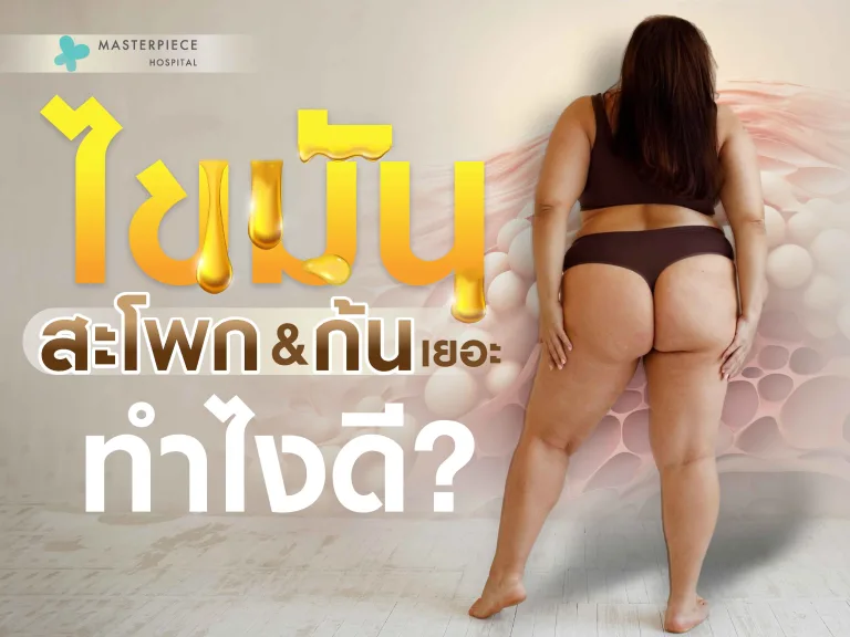 ไขมันสะโพกและก้นเยอะ ทำไงดี?