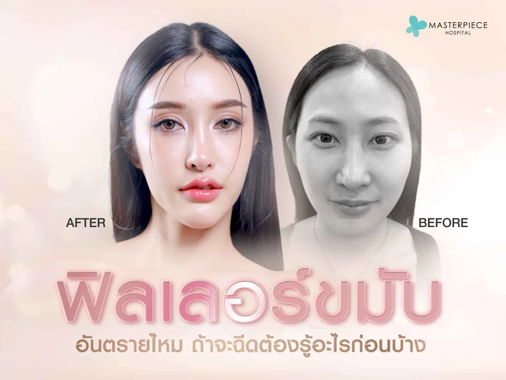 ฟิลเลอร์ขมับอันตรายไหม ถ้าจะฉีดต้องรู้อะไรก่อนบ้าง