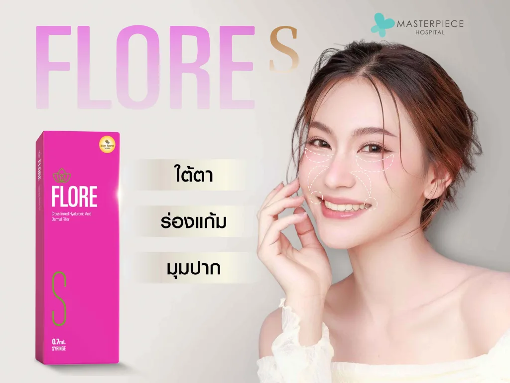 ฟิลเลอร์ Flore S