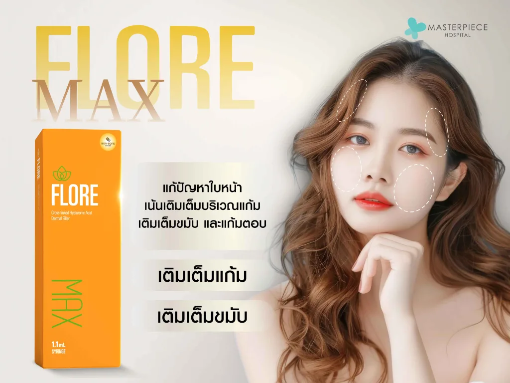 ฟิลเลอร์ Flore Max