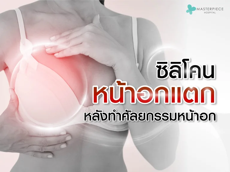 ซิลิโคนหน้าอกแตก รั่ว หลังทำศัลยกรรมหน้าอก?
