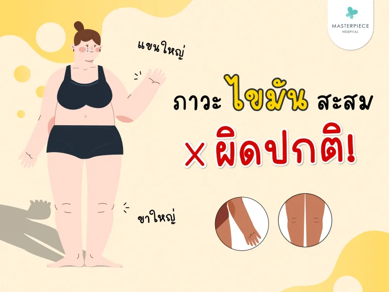 ขาใหญ่ แขนใหญ่ ไม่ใช่แค่อ้วน รู้จักภาวะไขมันสะสมผิดปกติ