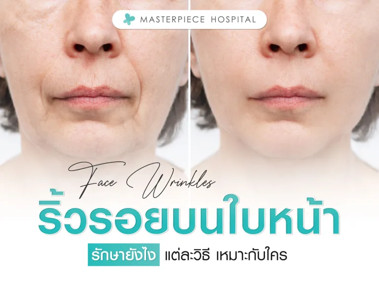ริ้วรอยบนใบหน้า รักษายังไง แต่ละวิธี เหมาะกับใคร