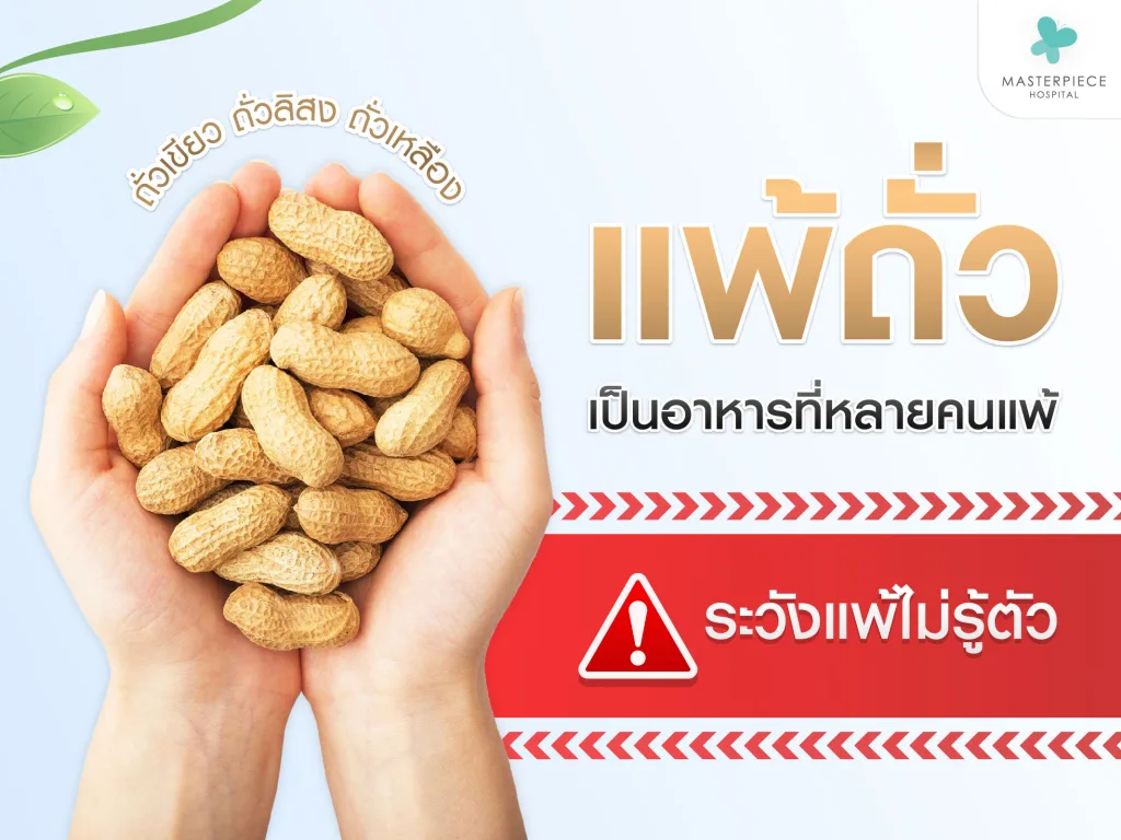 การแพ้ถั่ว อีกหนึ่งอาหารที่มีคนแพ้ไม่น้อย เราก็อาจจะแพ้แต่ไม่รู้ตัว