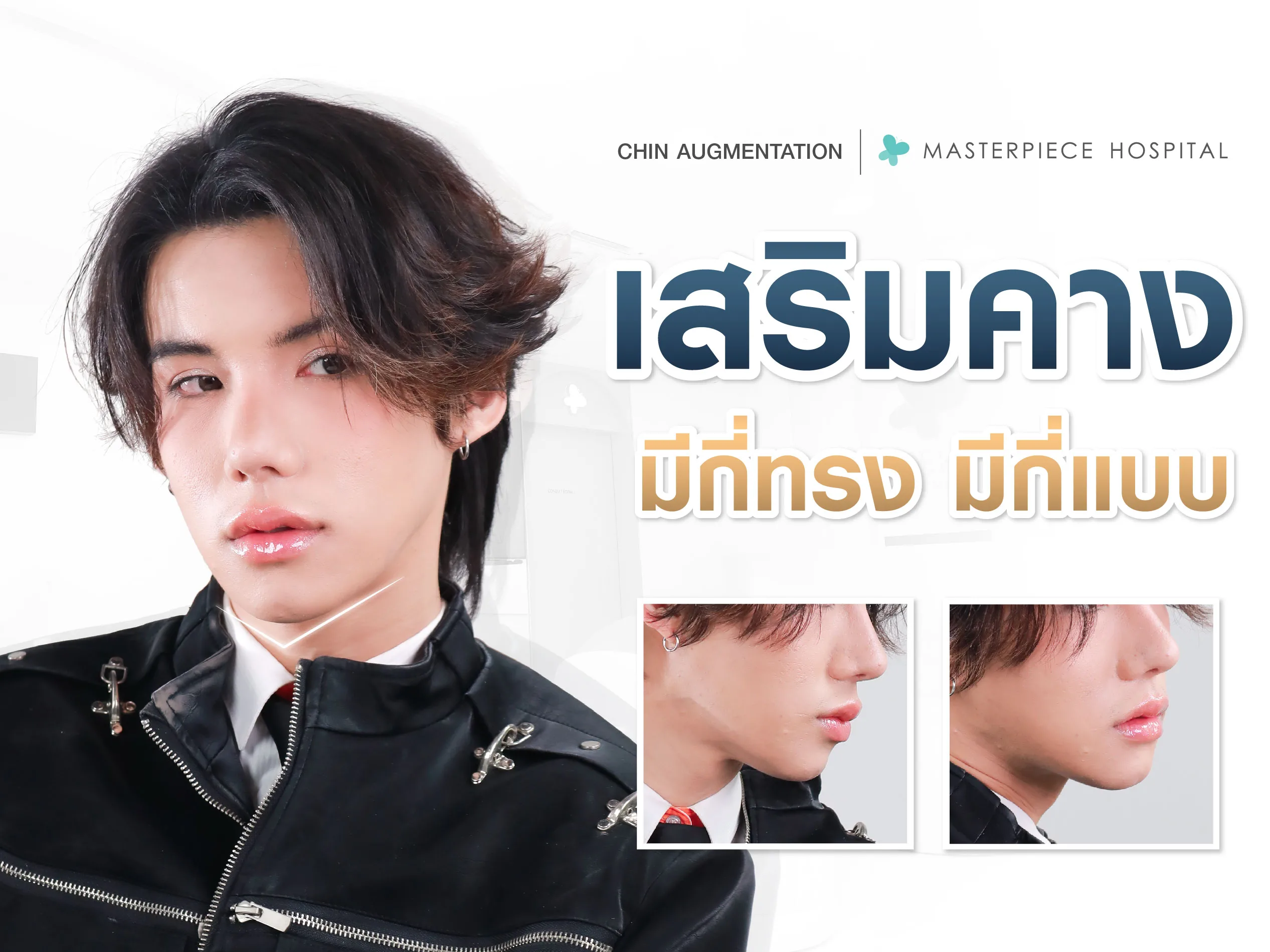 เสริมคางมีกี่ทรง มีกี่รูปแบบ ทรงคางสวยๆ รูปหน้าเรียว ละมุนสวย ?