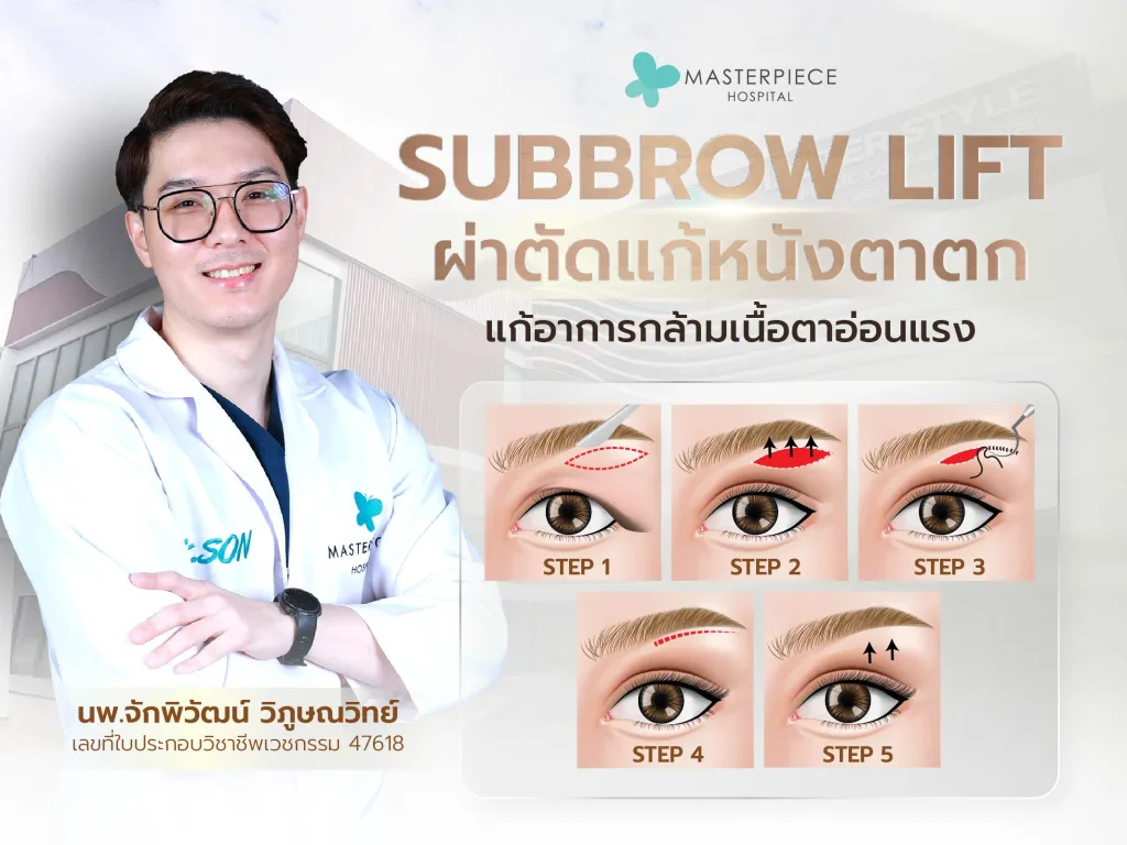 Subbrow lift ผ่าตัดแก้หนังตาตก แก้อาการกล้ามเนื้อหนังตาอ่อนแรง