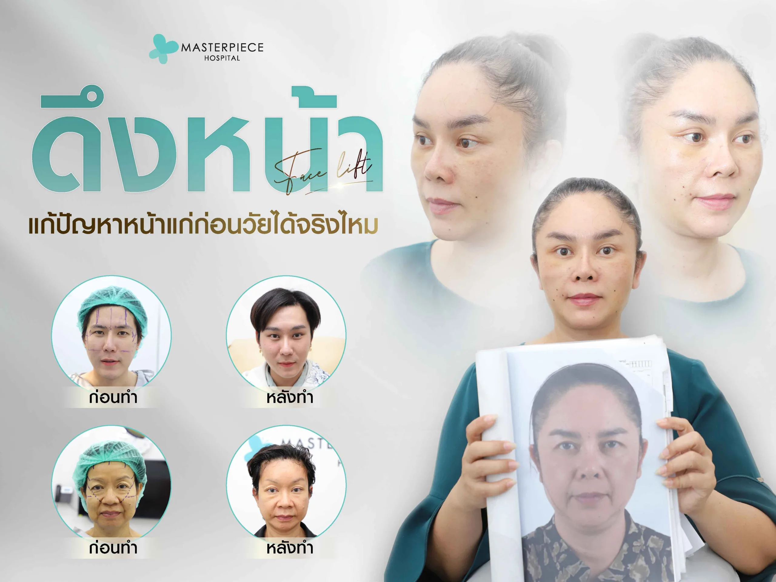 ดึงหน้าแก้ปัญหาหน้าแก่ก่อนวัยได้จริงไหม