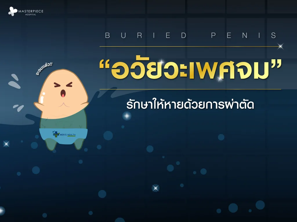 buried penis หรือ อวัยวะเพศจมไม่ต้องตกใจ รักษาให้หายได้ด้วยการผ่าตัด