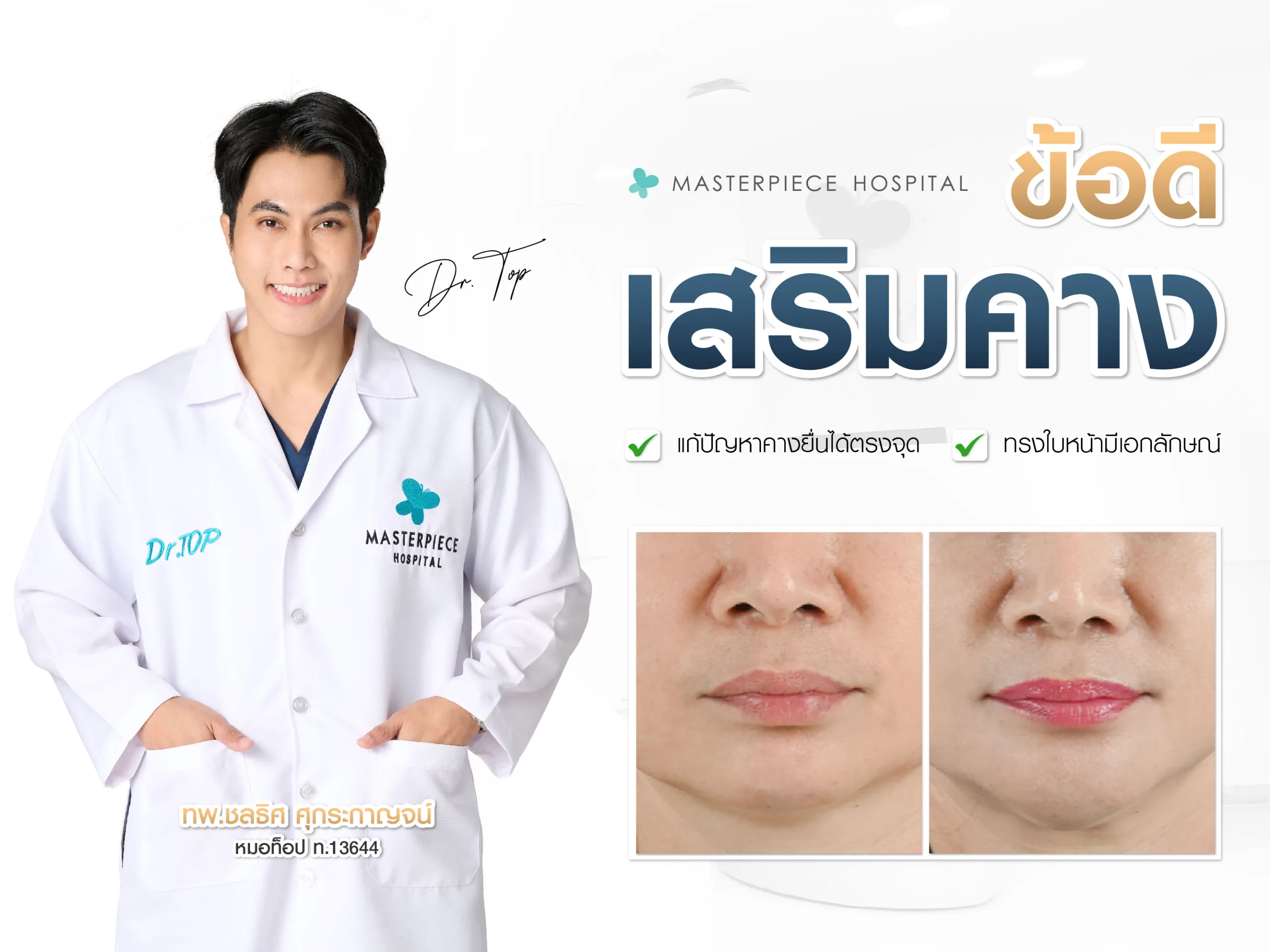 ข้อดีเสริมคาง