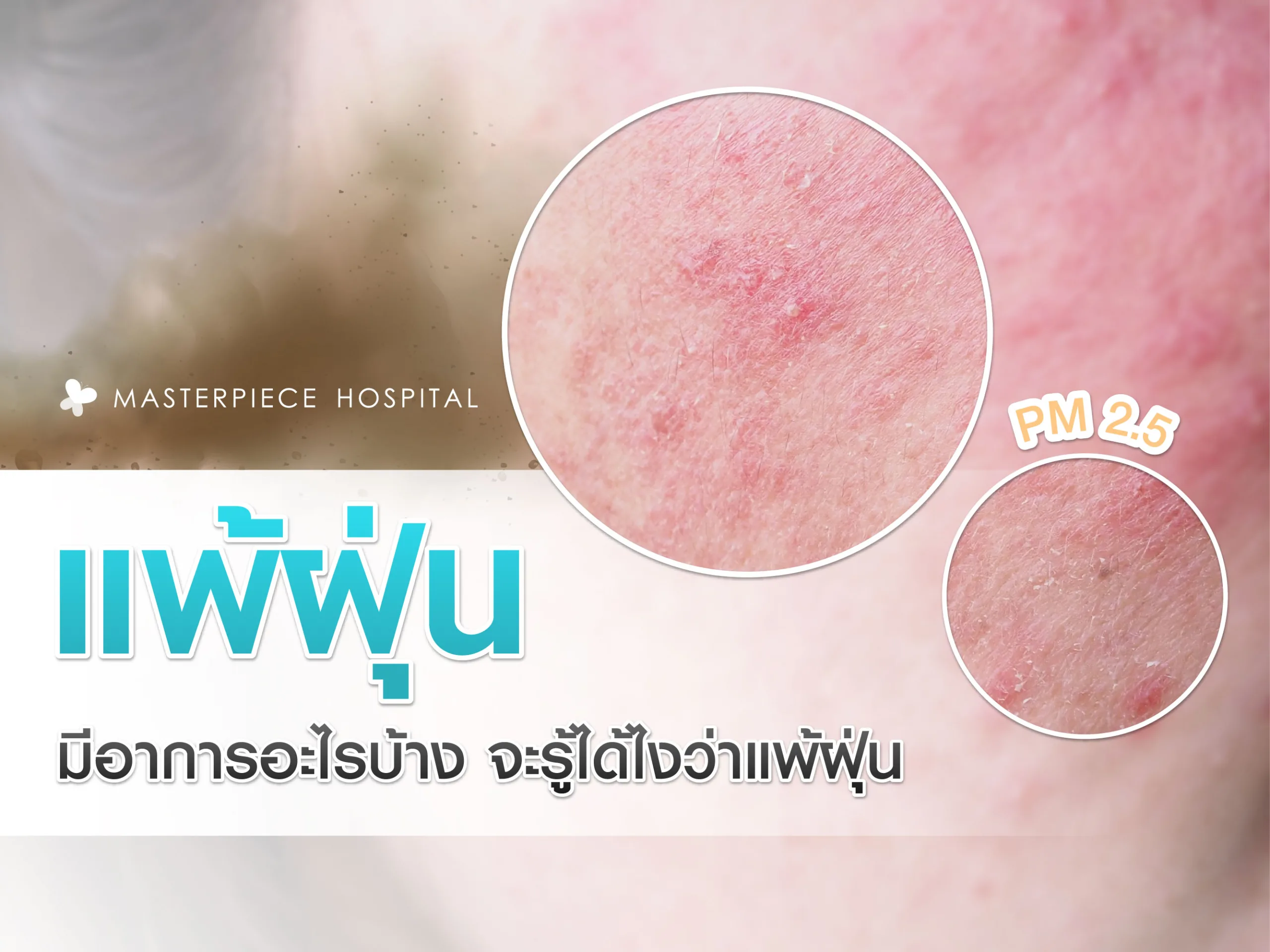 แพ้ฝุ่นมีอาการอะไรบ้าง จะรู้ได้อย่างไรว่าแพ้ฝุ่น
