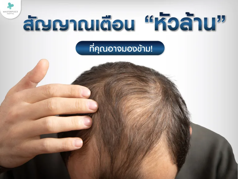 7 สัญญาณเตือนหัวล้านที่คุณอาจมองข้าม
