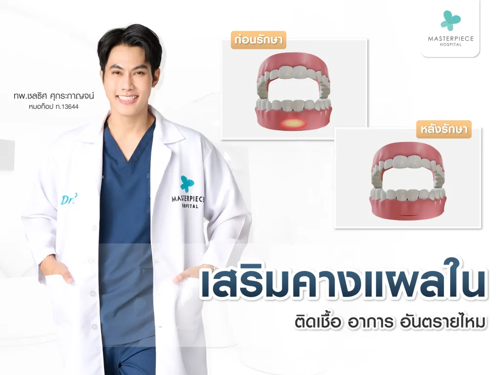 เสริมคางแผลใน ติดเชื้อ อันตรายไหม