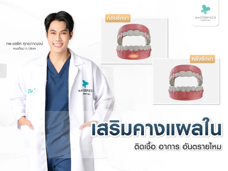 เสริมคางแผลใน ติดเชื้อ อันตรายไหม