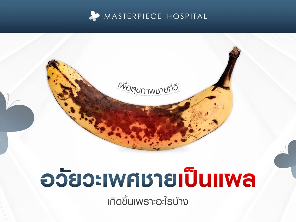 เป็นแผลที่อวัยวะเพศชายรักษาอย่างไร เกิดขึ้นเพราะอะไรได้บ้าง