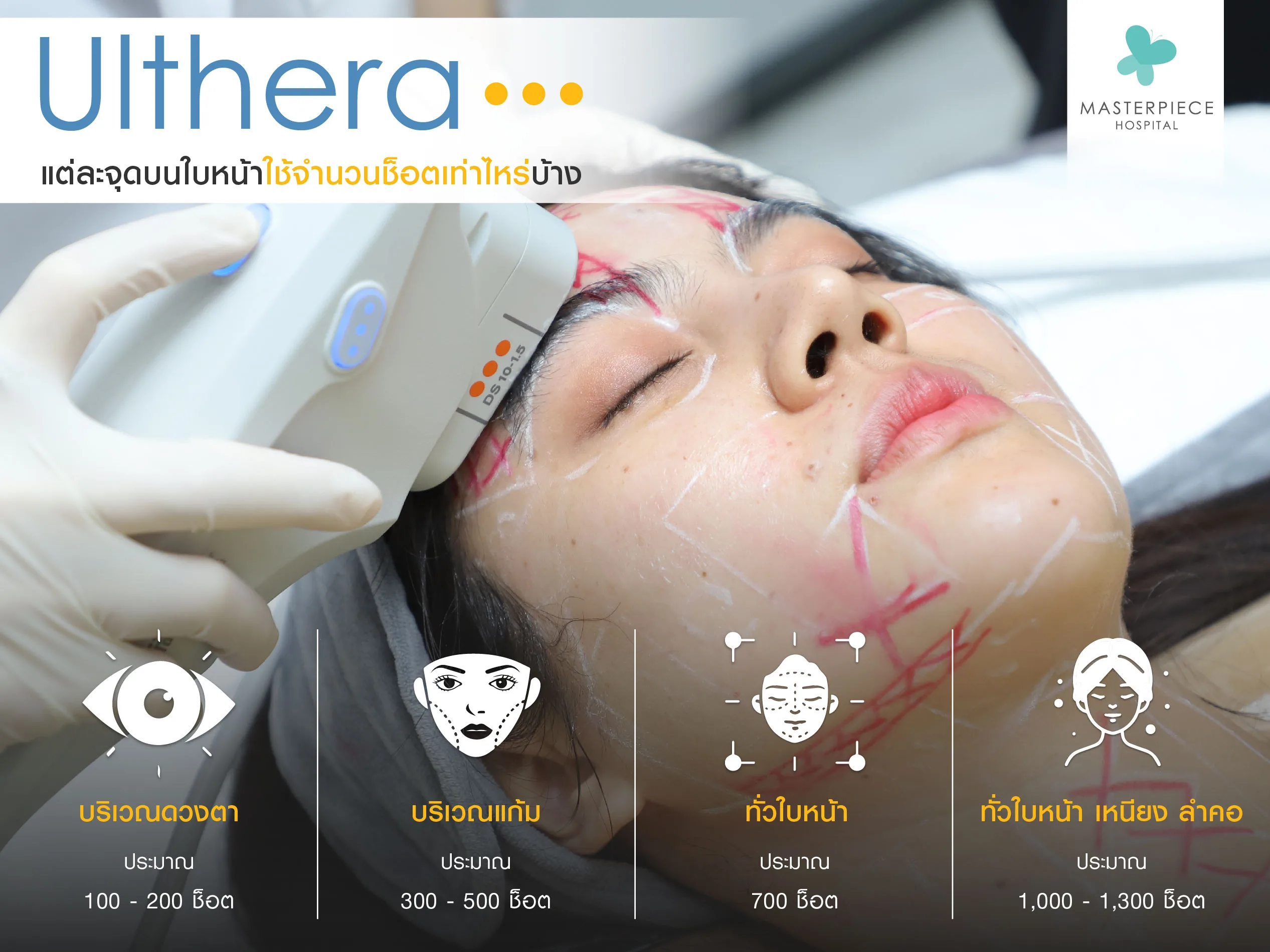 Ulthera แต่ละจุดบนใบหน้าใช้จำนวนช็อตเท่าไหร่บ้าง ?