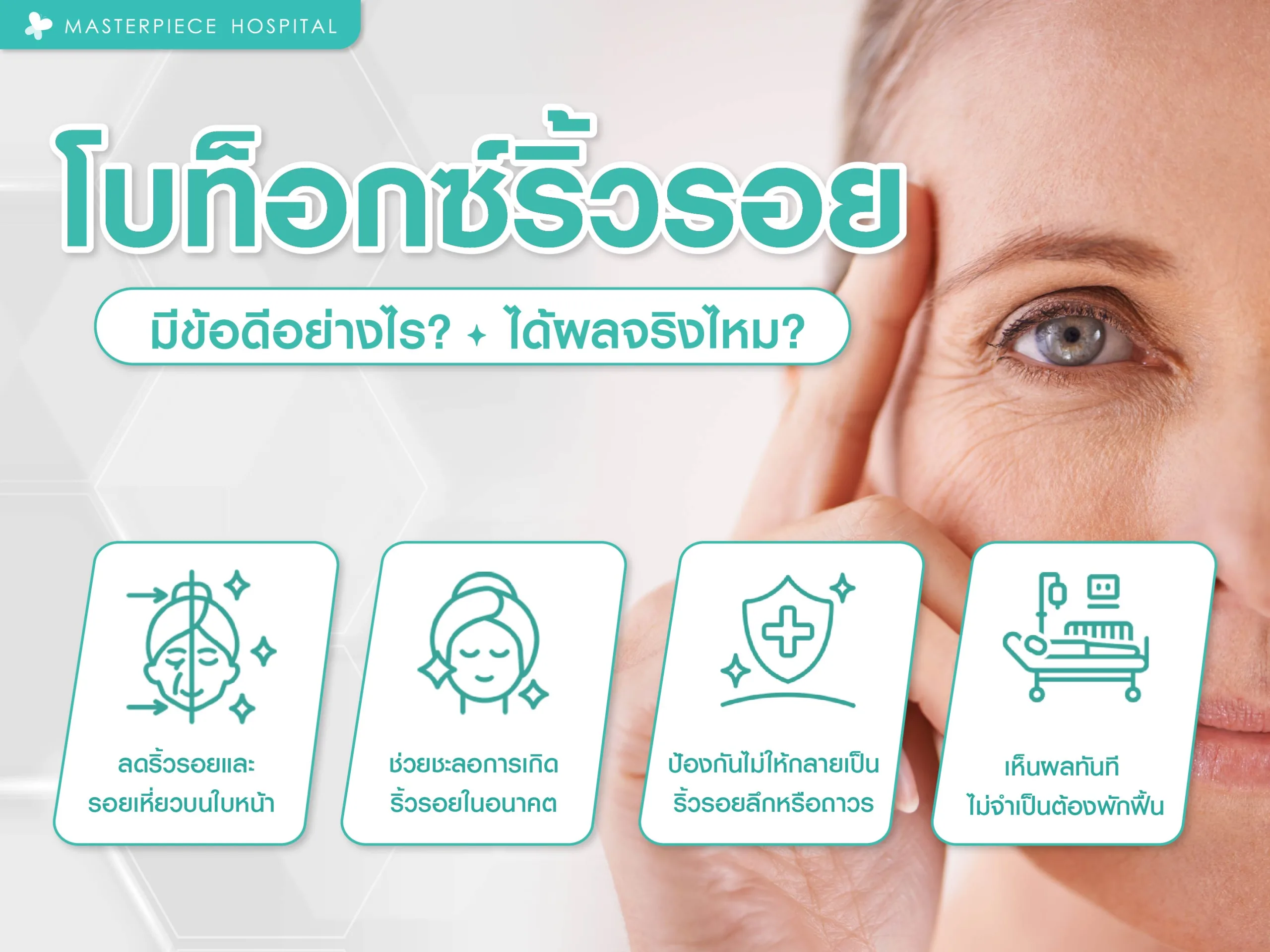 โบท็อกซ์ลดริ้วรอย   มีข้อดีอย่างไร ได้ผลจริงไหม