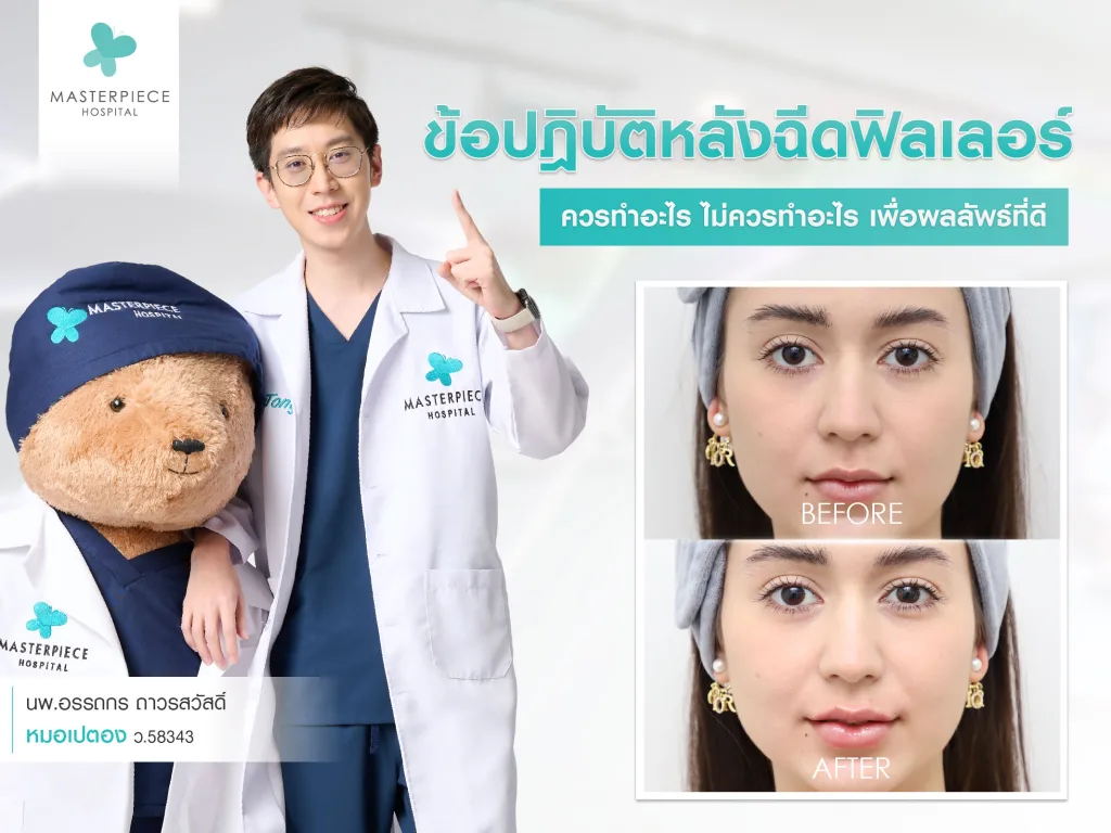 ข้อปฏิบัติหลังฉีด filler ควรทำอะไร ไม่ควรทำอะไร เพื่อให้ผลลัพธ์ที่ดี และอยู่กับเราได้นานที่สุด