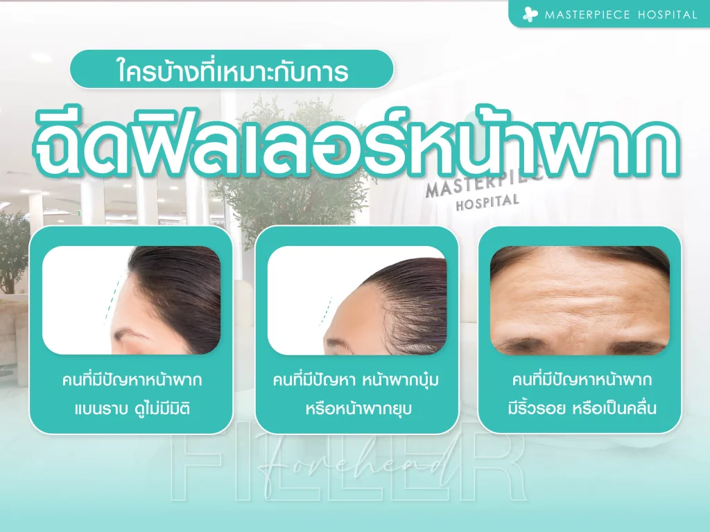 ใครบ้างที่เหมาะกับการฉีดฟิลเลอร์หน้าผาก