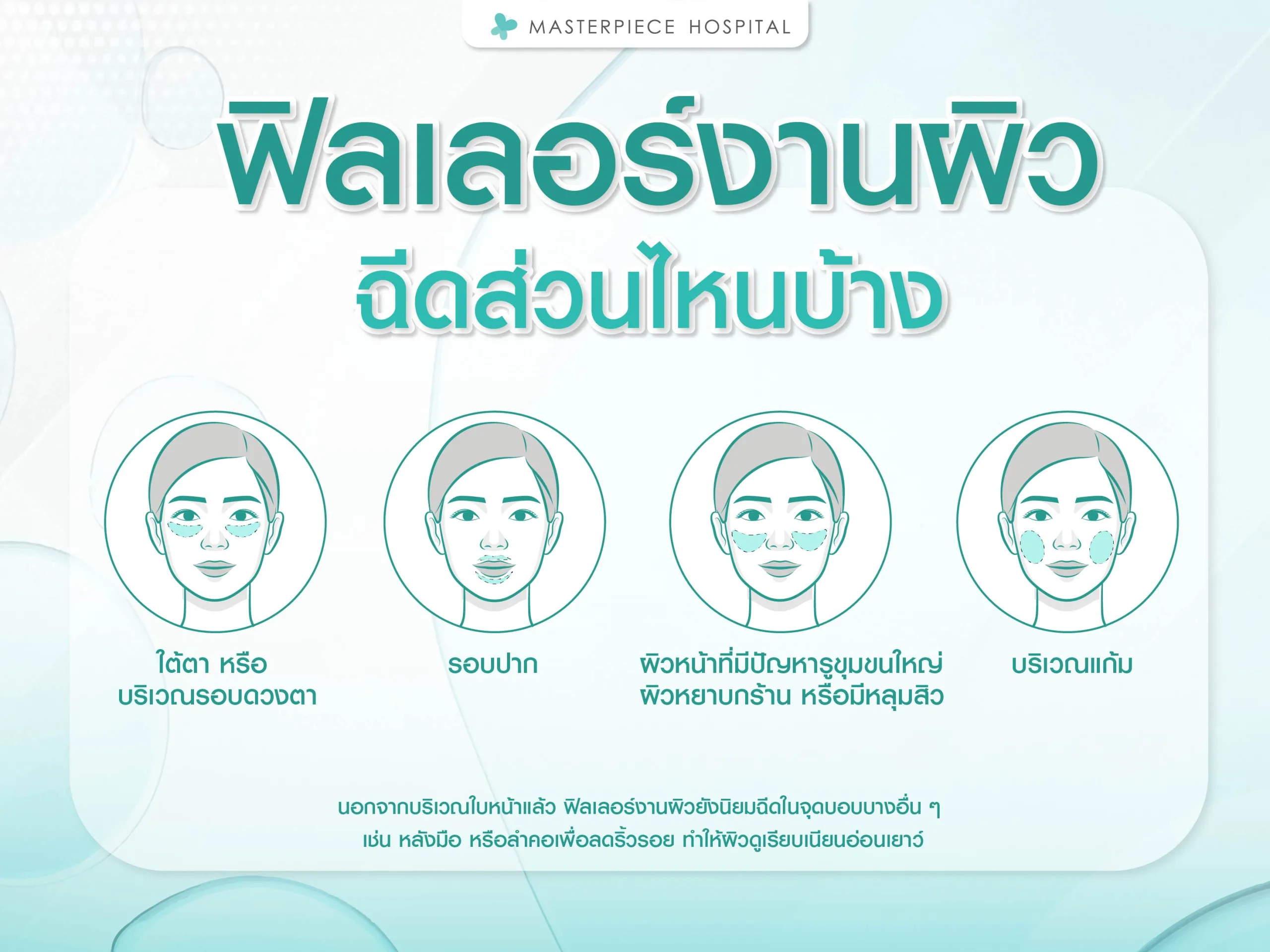 ฟิลเลอร์งานผิวฉีดส่วนไหนบ้าง