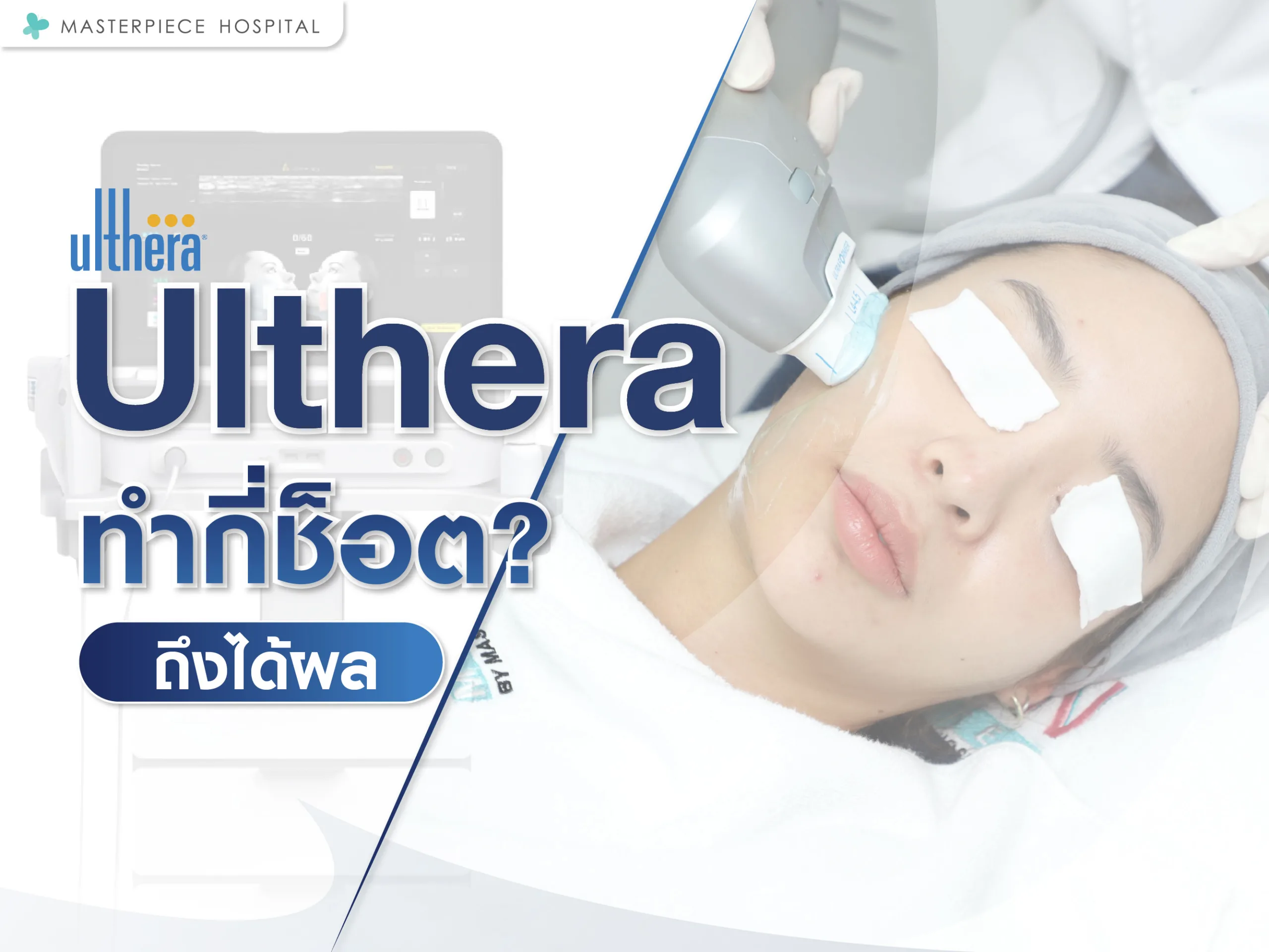 อัลเทอร่าทํากี่ช็อต (ไลน์) ถึงได้ผล ?