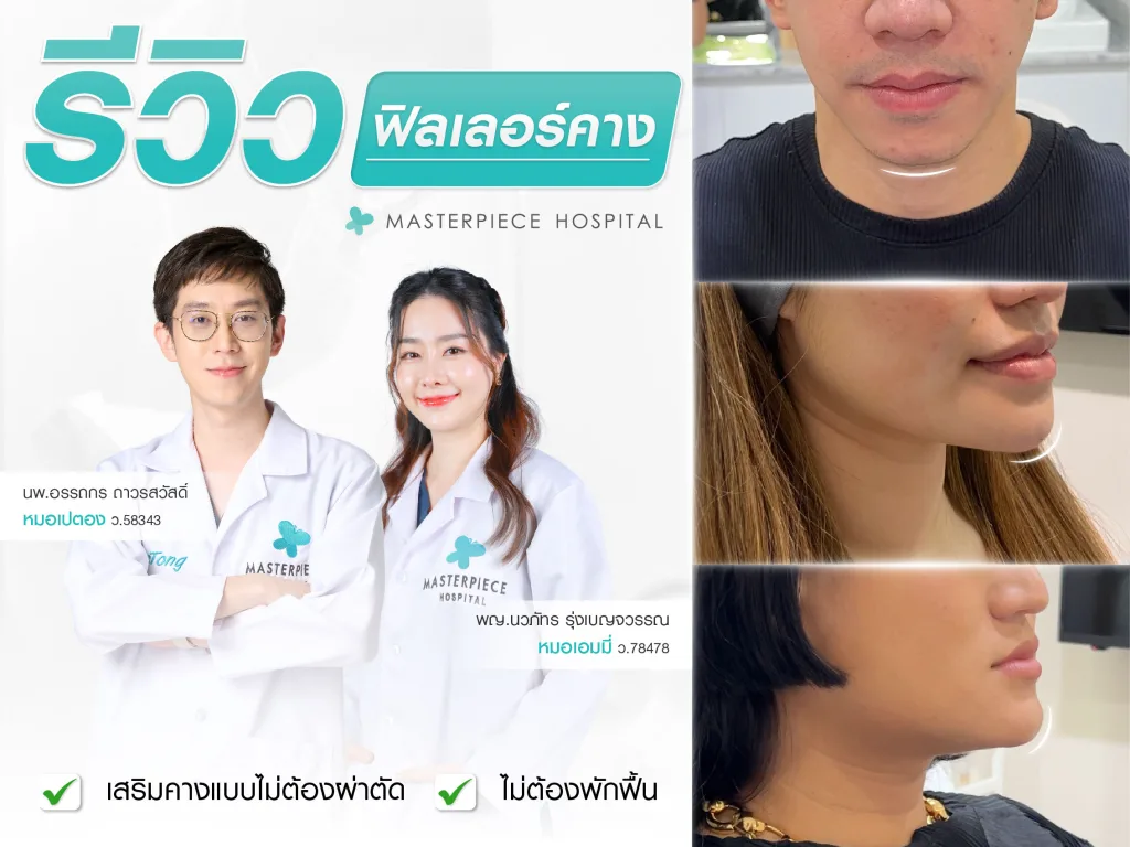 รวมรีวิวฉีดฟิลเลอร์คาง เสริมคางแบบไม่ต้องผ่าตัด ไม่ต้องพักฟื้น